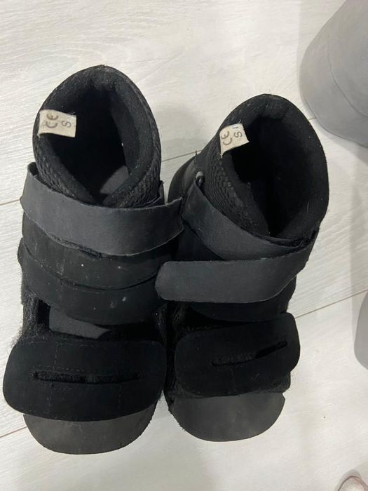 Халюс вальгус