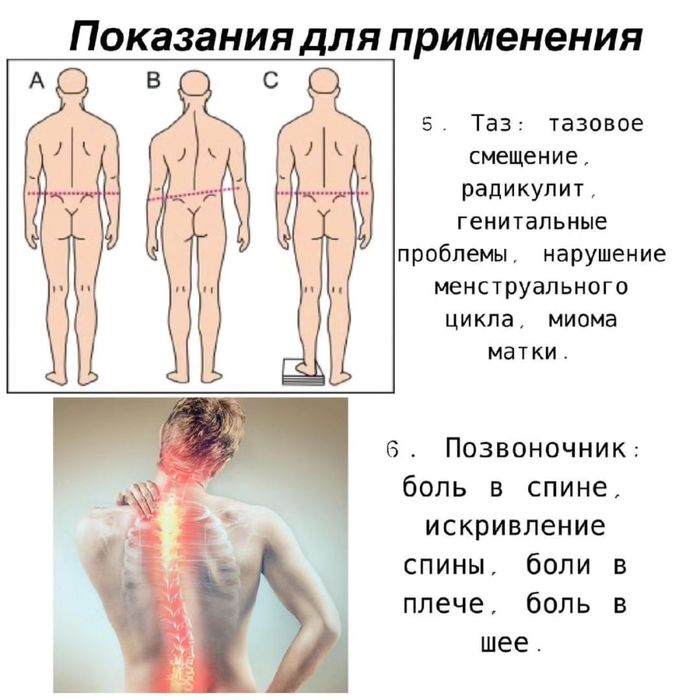 Коррекционные стельки Whieda