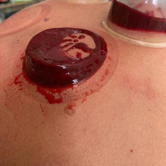 Оздоровительная хиджама