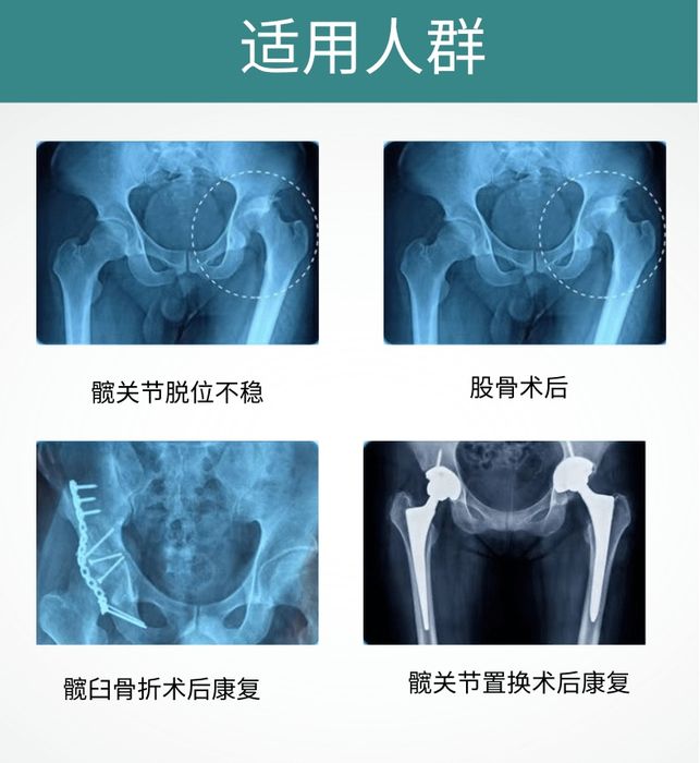 Детский Бандаж для тазобедренного сустава ортез фиксатор универсальный