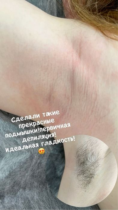 Депиляция Шугаринг Ламинирование бровей ресниц Архитектура бровей