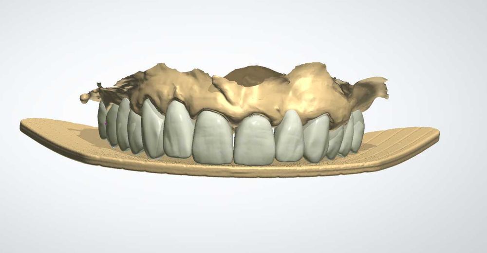 CAD/CAM дизайн |Корони, мостове, барове| 3Shape | Blender for Dental |
