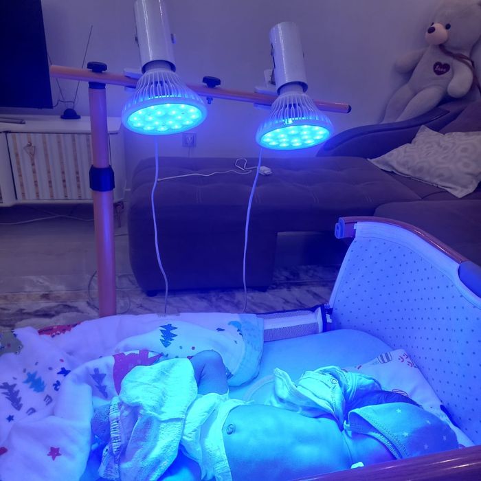 Фотолампа Билитест  Каскелен