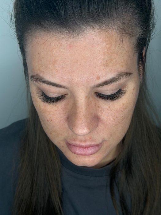 Aplicare extensii de gene