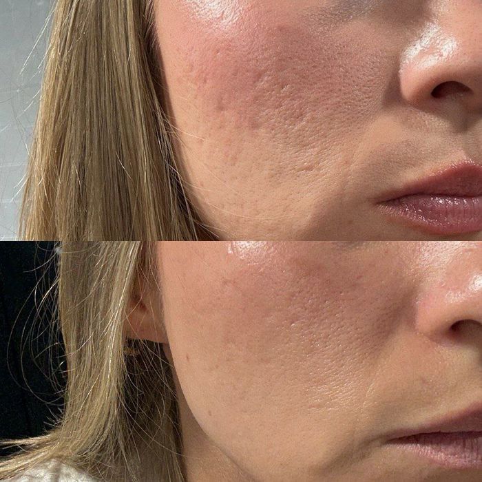 Косметолог Шахноза.Сергили