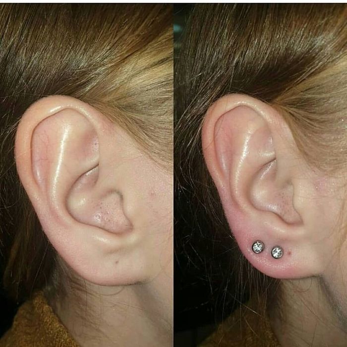 Услуги по уходу за кожей лица