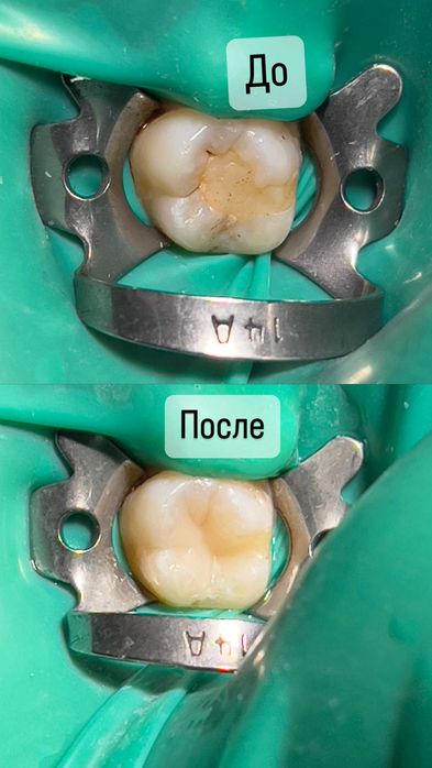 Стоматологические услуги (лечение, удаление, реставрация)
