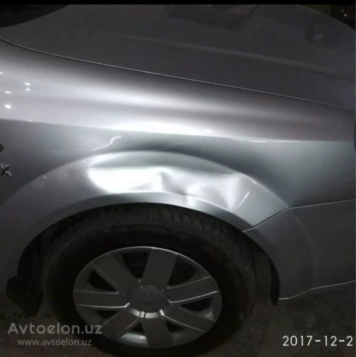 Vakumshik.uz Yunisabod Chinabot sanatoriyasini oldida