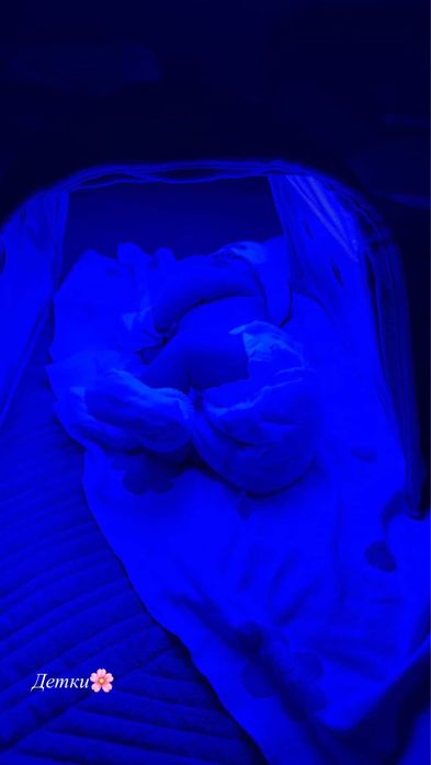 Лампа от желтушки