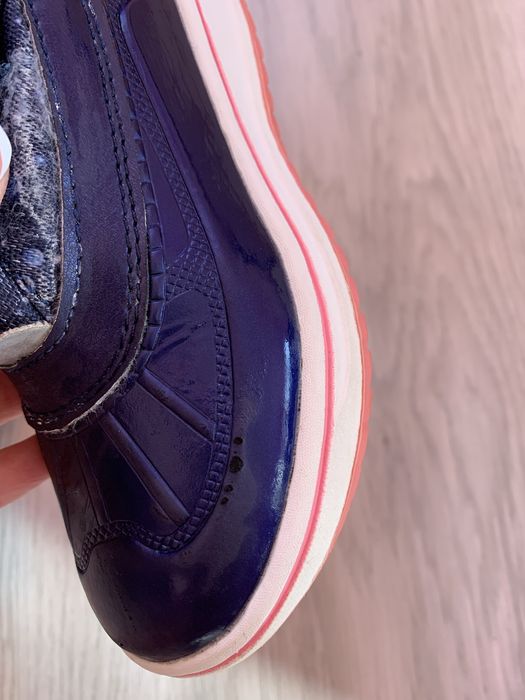 Детски апрески