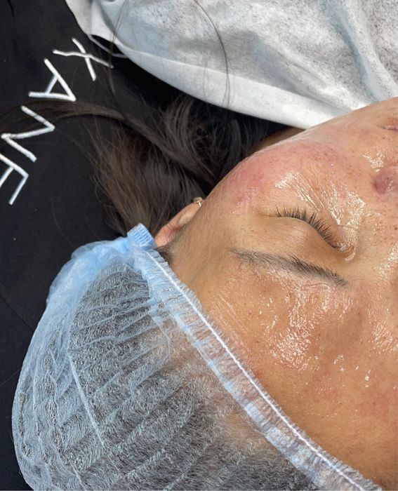 Чистка лица, уход.