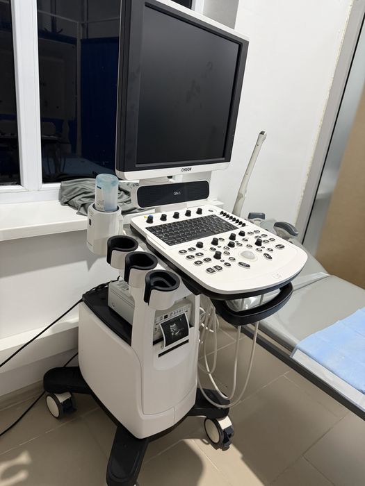 УЗИ аппарат  Chison QBit 5