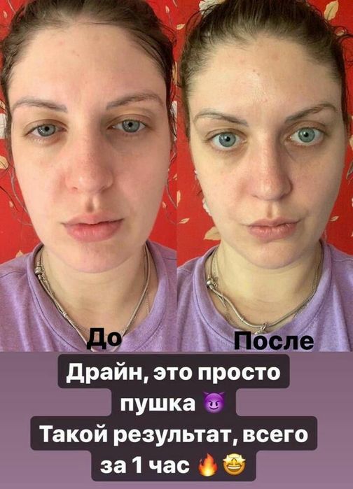 Запускает процесс похудения,долой отёки - Озиш жараёнини бошлаб беради