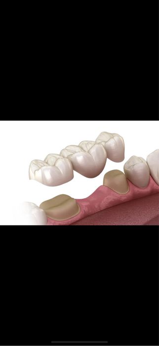 Gratuit tratament dinti