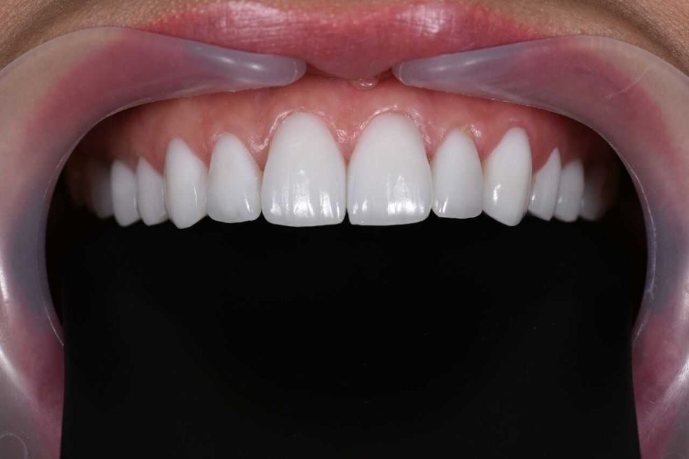 зуботехническая лаборатория CAD/CAM для точности и качества