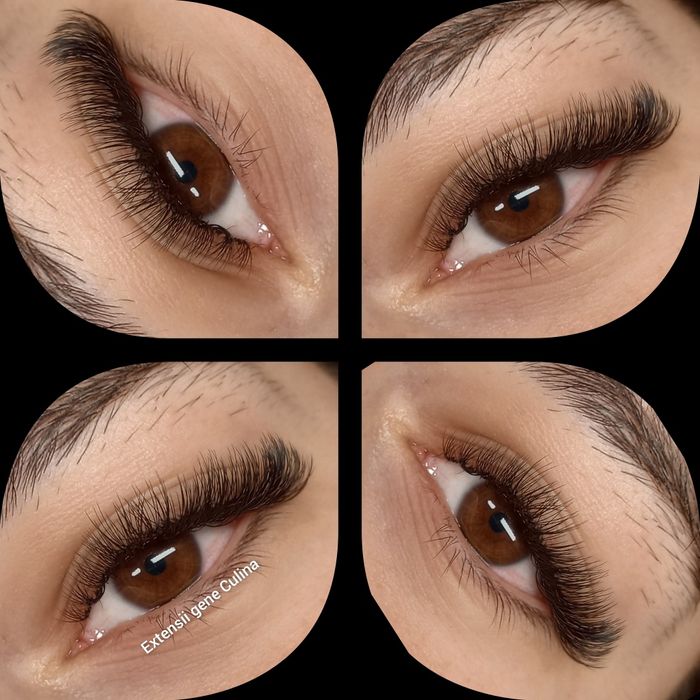 Extensii gene Galați