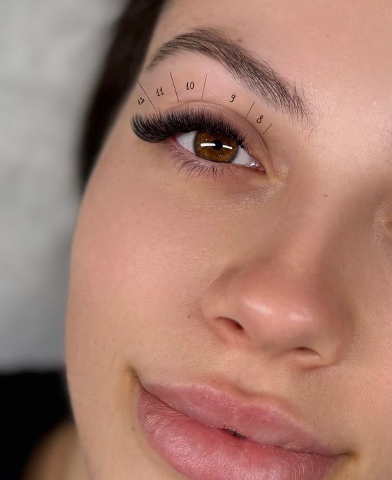 Servicii extensii gene - laminare