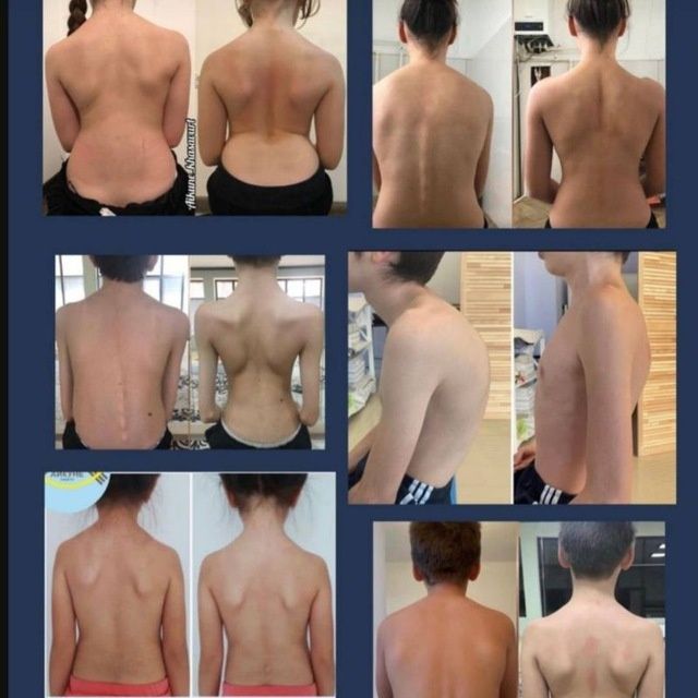 Мастер гимнастики АЙКУНЕ