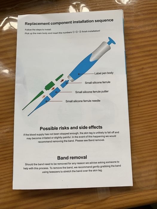 Устройство удаление папиллом