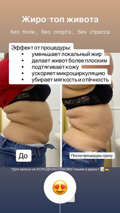 Холодная поазма  в Павлодаре