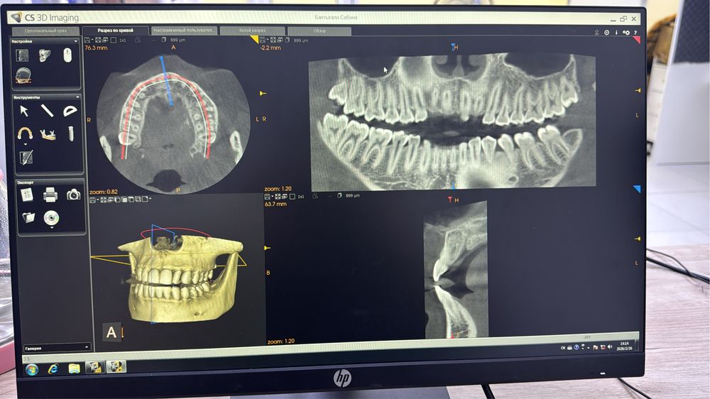 3D рентген апаррат