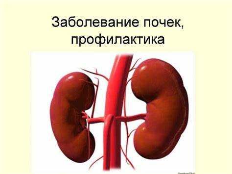 Видео, статьи на диске, Заболевания почек, профилактика