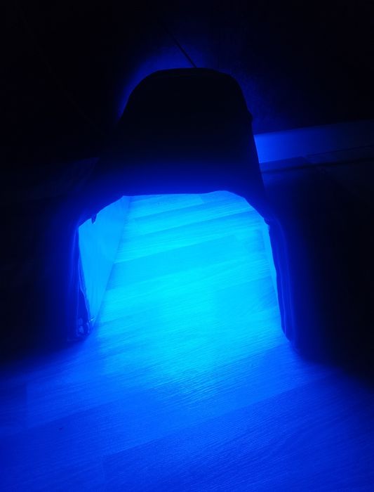 Фотолампа от желтуки