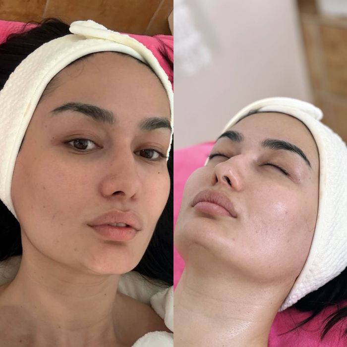 Косметолог эстет все уход и инъекционные процедуры