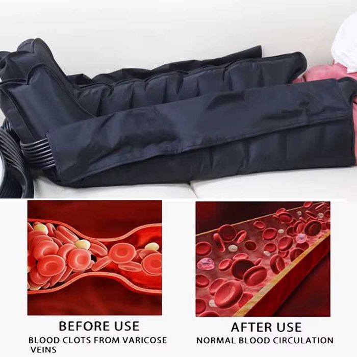 Aparat presoterapie, drenaj limfatic, marimea XL