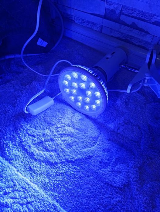 Фотолампа лечение желтухи