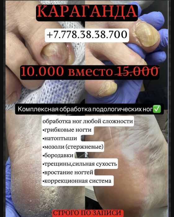 Ногтевой сервис -подология