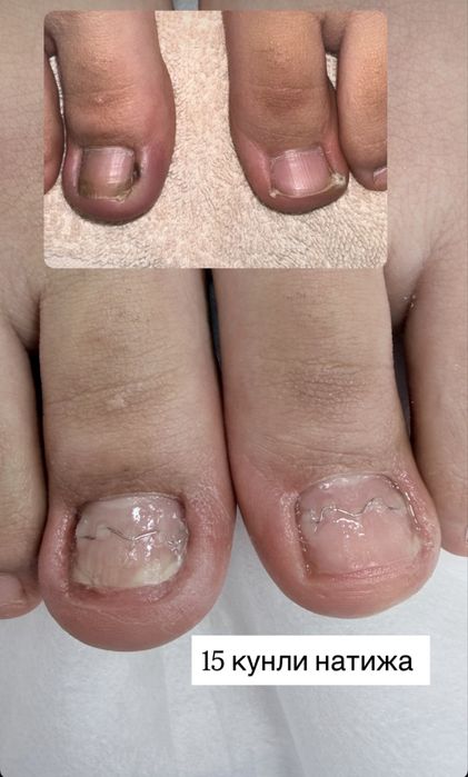 Маникюр и педикюр