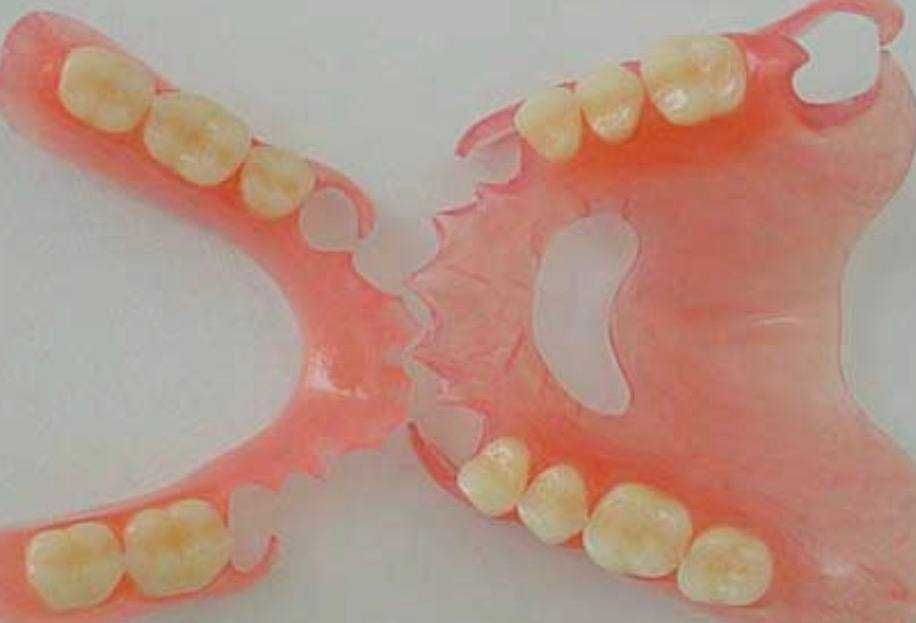 Протез на зубы Алматы