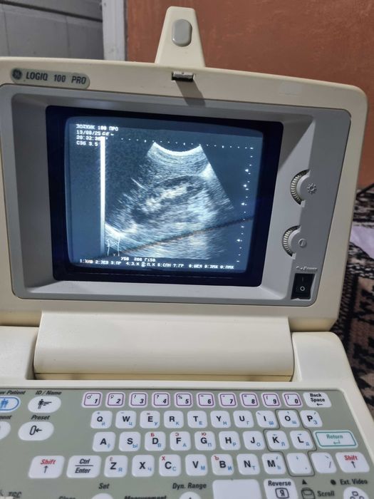 Uzi apparat GE logiq 100 pro