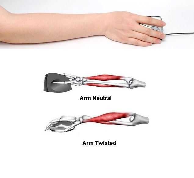 Новая! Вертикальная мышь VerticalMouse4 от Evoluent