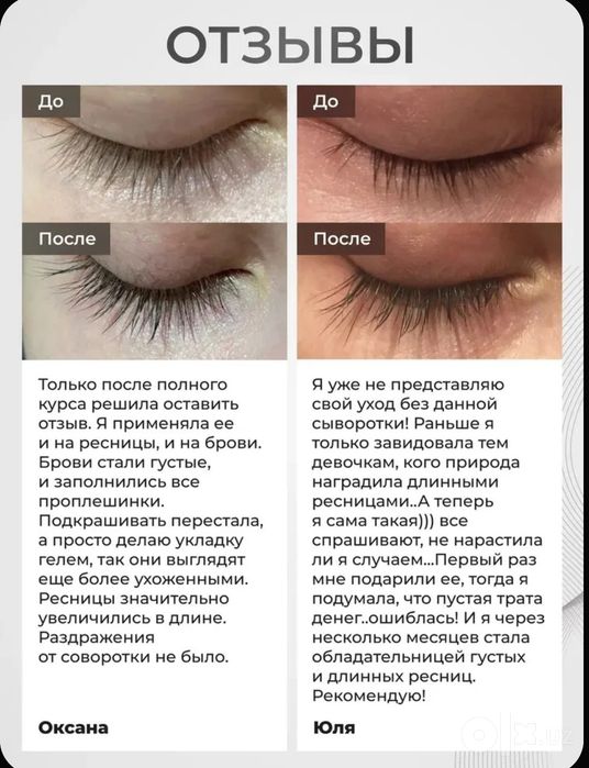 Kiprik va qosh o'stirish uchun Queenlash