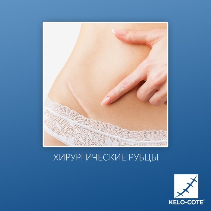 Kelo-Cote 10g-60g- силиконовый гель для рассасывания рубцов
