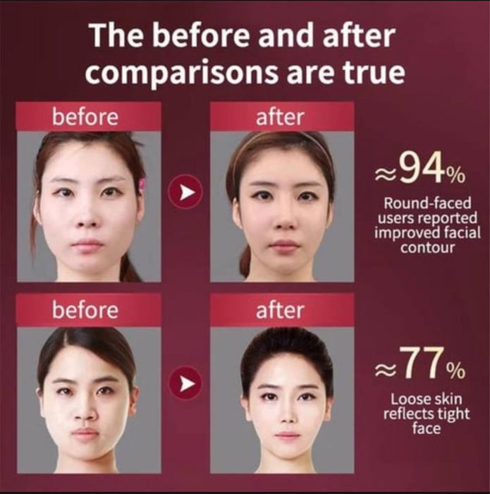 Продается массажер для похудения лица