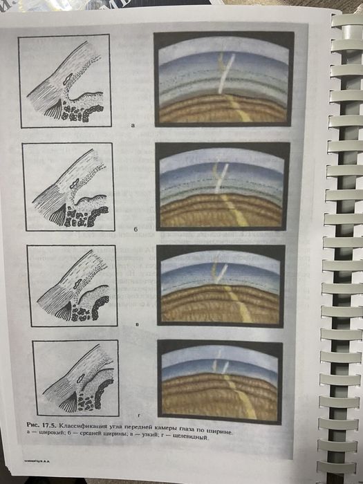 Глазные болезни Копаева