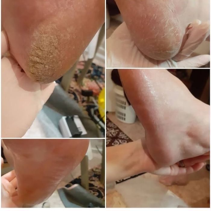 Маникюр Педикюр Выезд!!!