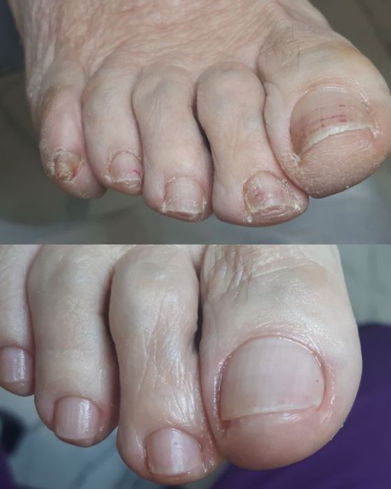 Педикюр  педикюр