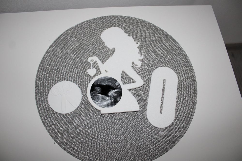 Ramă foto-Prima radiografie bebe