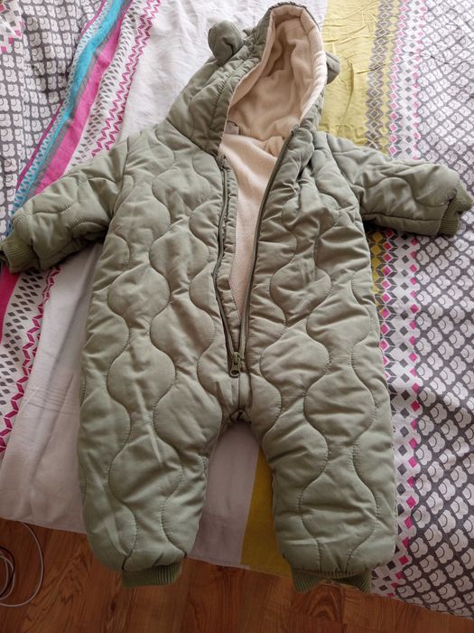 Гащиризон на бебе