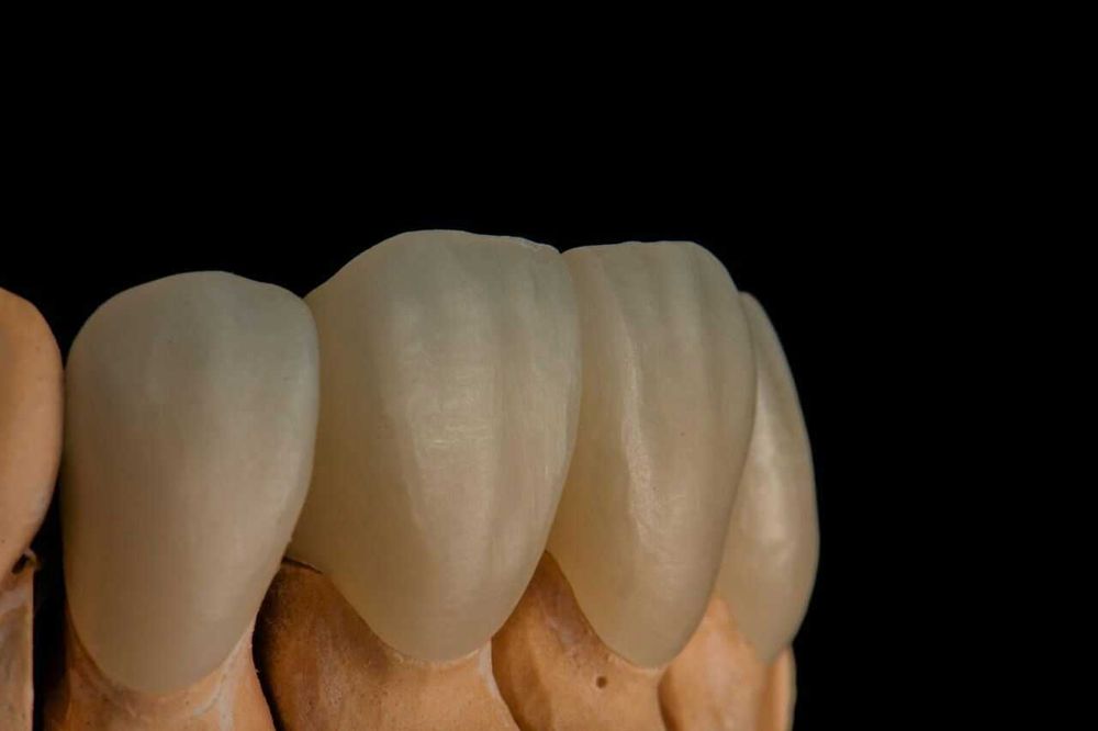 Зуботехническая CAD/CAM услуги в стоматологии Опыт работы 15 лет