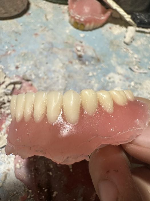 Изготовление сьемных протезов