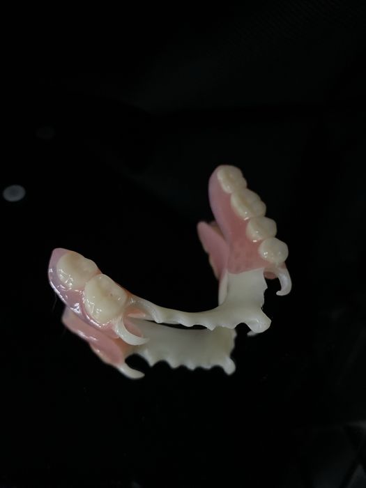 Вакуумные протезы, съемные протезы. ДОСТУПНЫЕ ЦЕНЫ