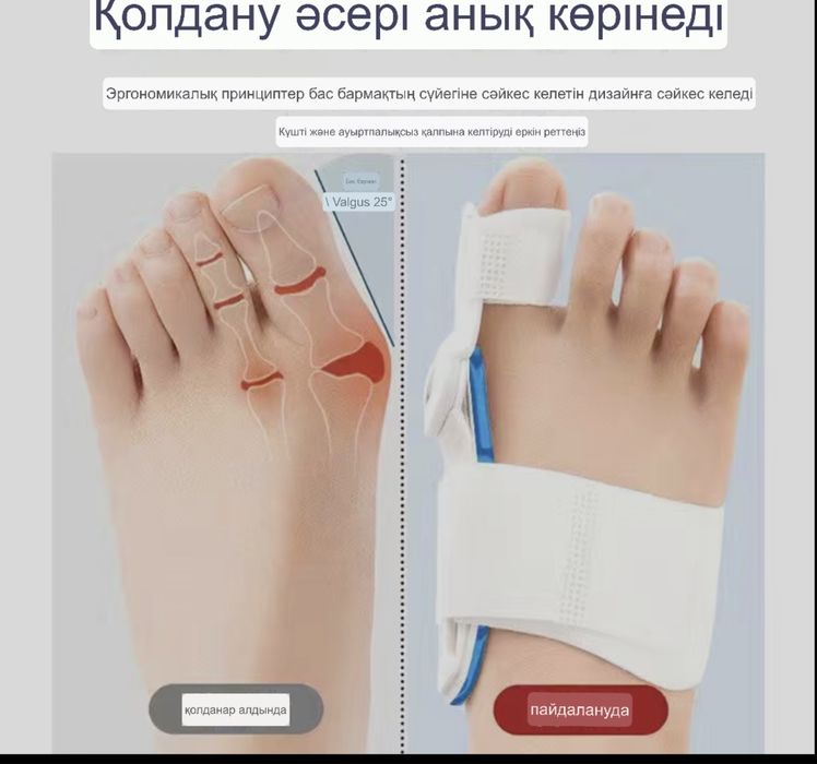 Корректор для ноги/день и ночь