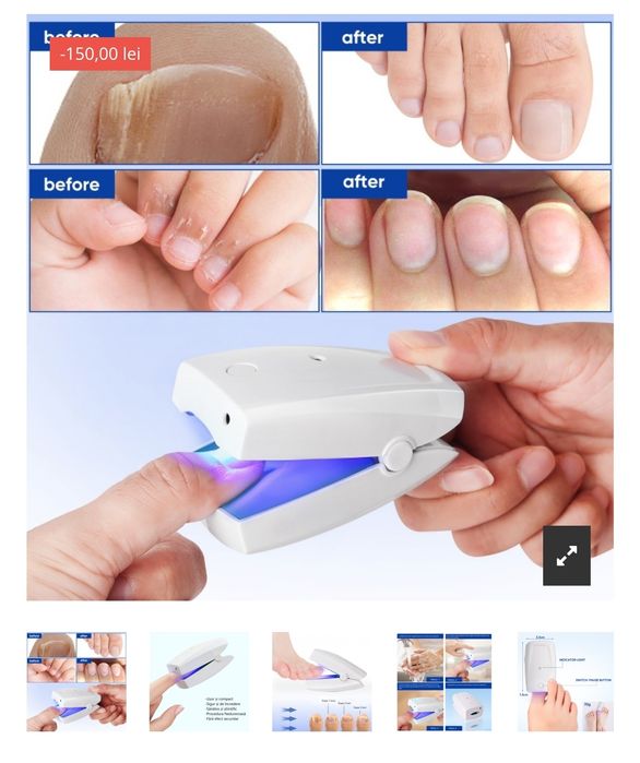 Aparat cu laser pentru afectiuni ale Unghiei RK6000FL, lumina albastră