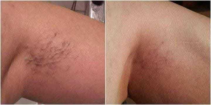 Фитогел Славитон