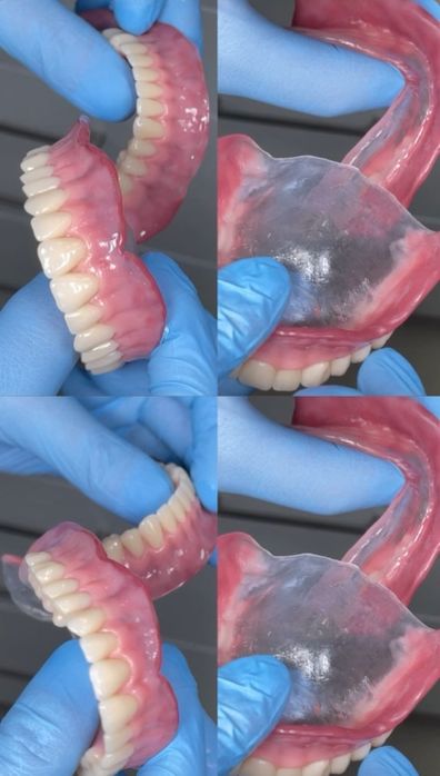 Все виды зубной протезы ,каппы элайнеры